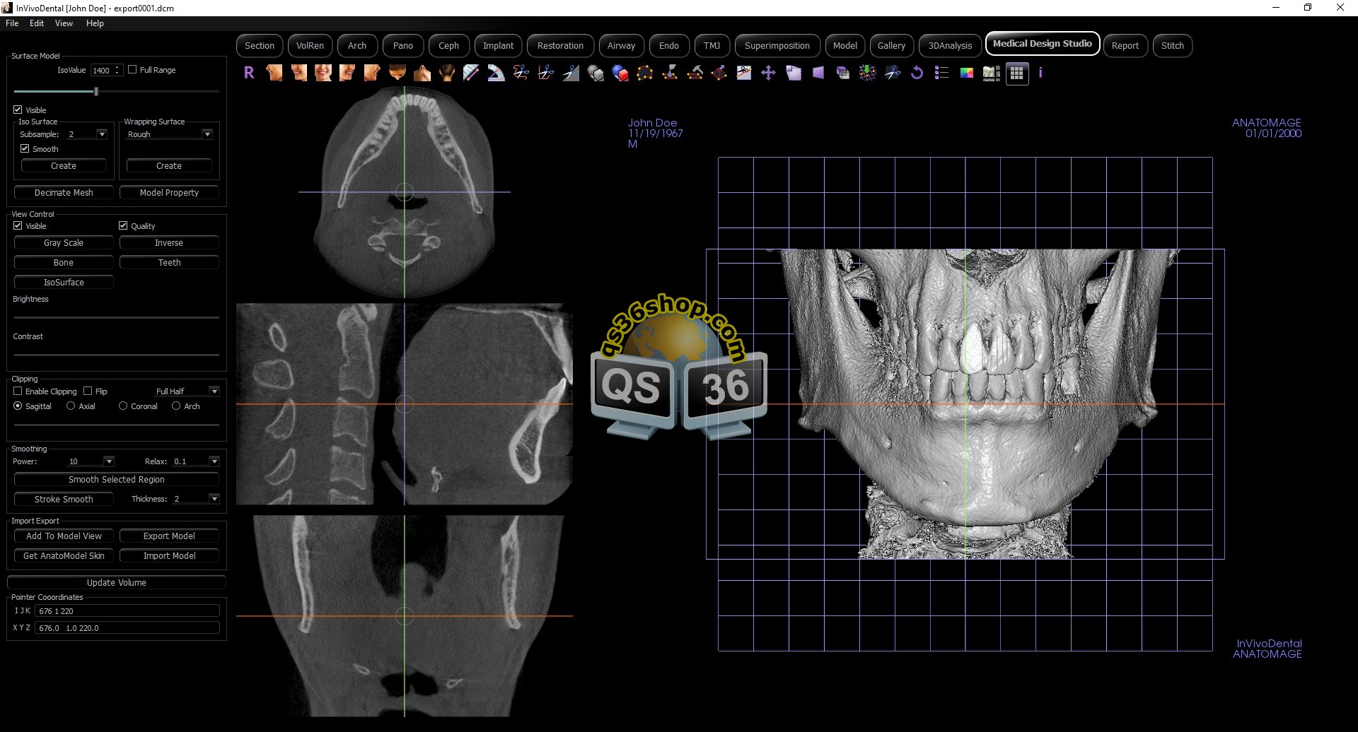 Anatomage In Vivo Viewer
